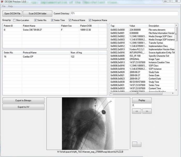 DICOM Preview 1.1.6软件截图（1）