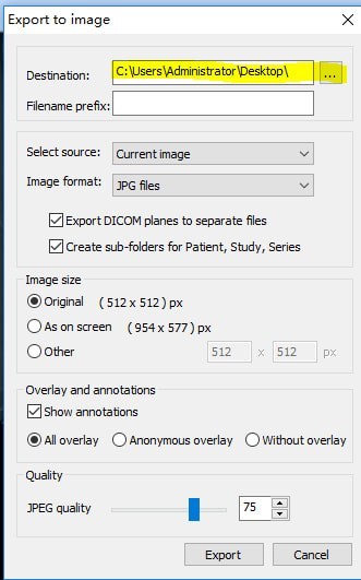 MicroDicom viewer(Dicom格式看图软件) 2.9.2软件截图（2）