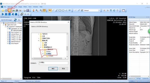 MicroDicom viewer(Dicom格式看图软件) 2.9.2软件截图（3）