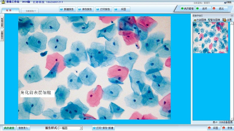 液基细胞图文报告系统 2014软件截图（1）
