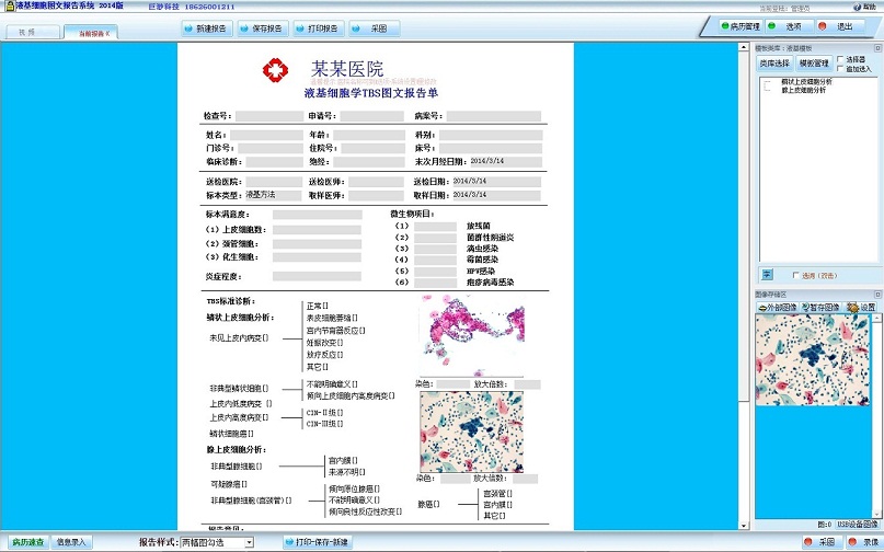 液基细胞图文报告系统 2014软件截图（2）