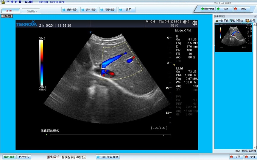 超声影像工作站 2014软件截图（1）