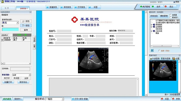 超声影像工作站 2014软件截图（2）